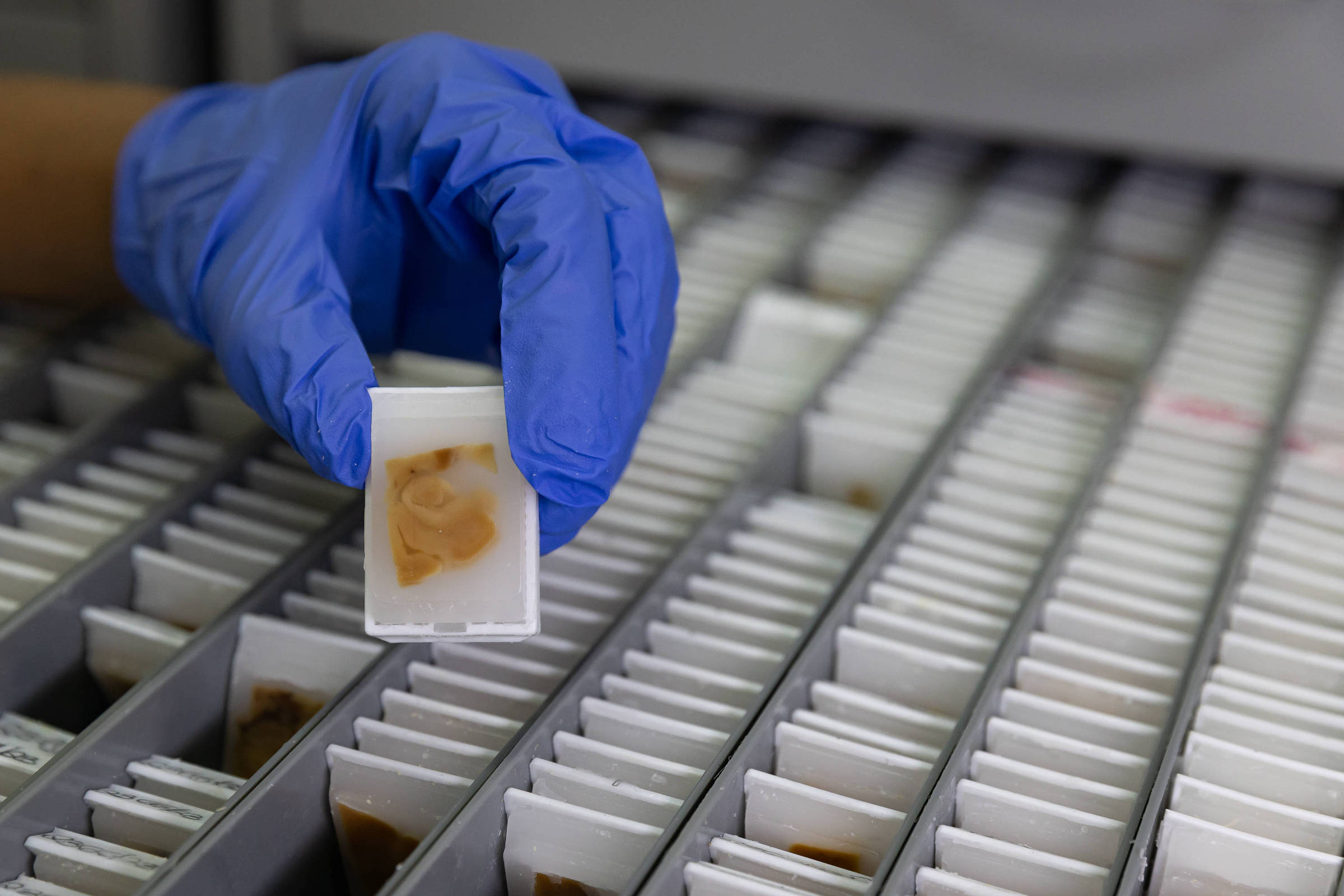 Estudo da USP vê ligação entre álcool e risco de demência – 09/04/2025 – Equilíbrio e Saúde